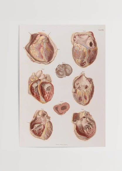 Farklı açılardan kesitleri gösteren vintage anatomik kalp illüstrasyonlarının bulunduğu tıbbi poster.